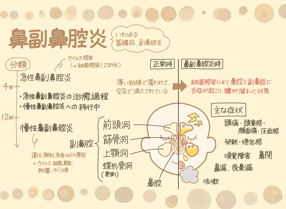 鼻副鼻腔炎の急性～慢性の分類と主な症状