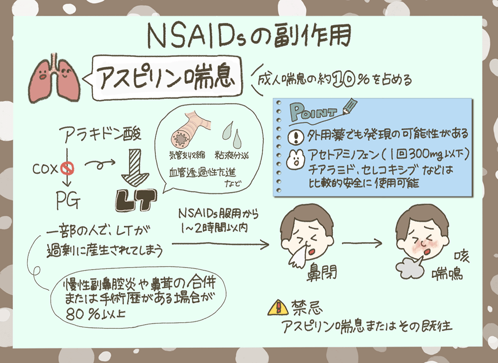 アスピリン喘息：NSAIDsの副作用について