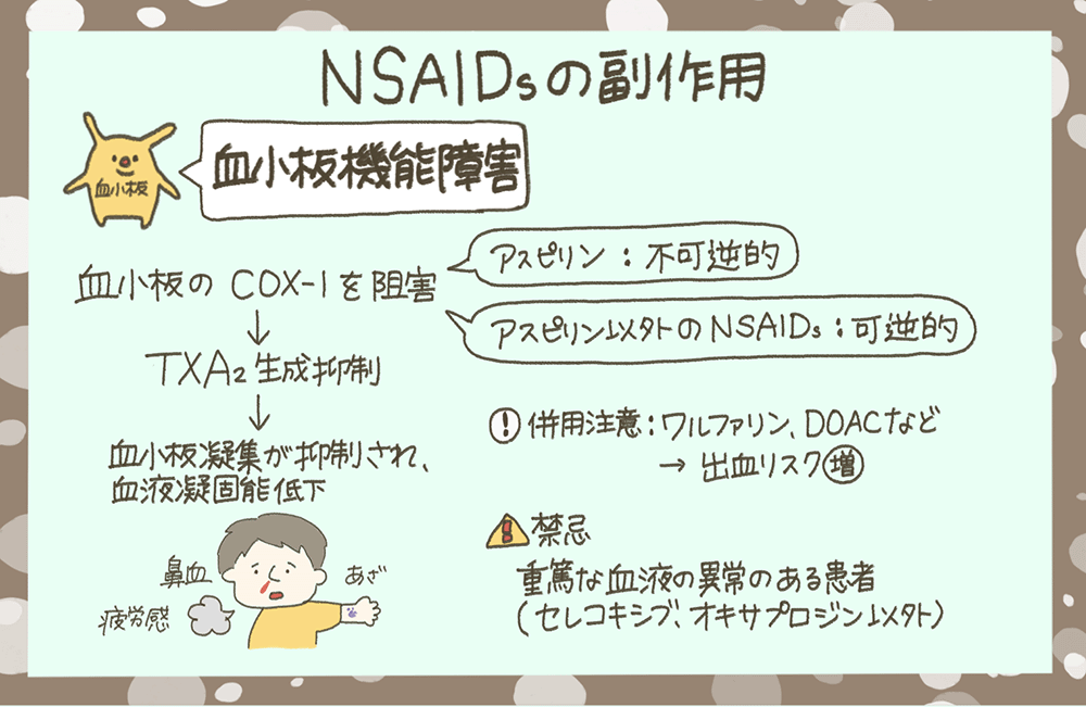 血小板機能障害：NSAIDsの副作用について
