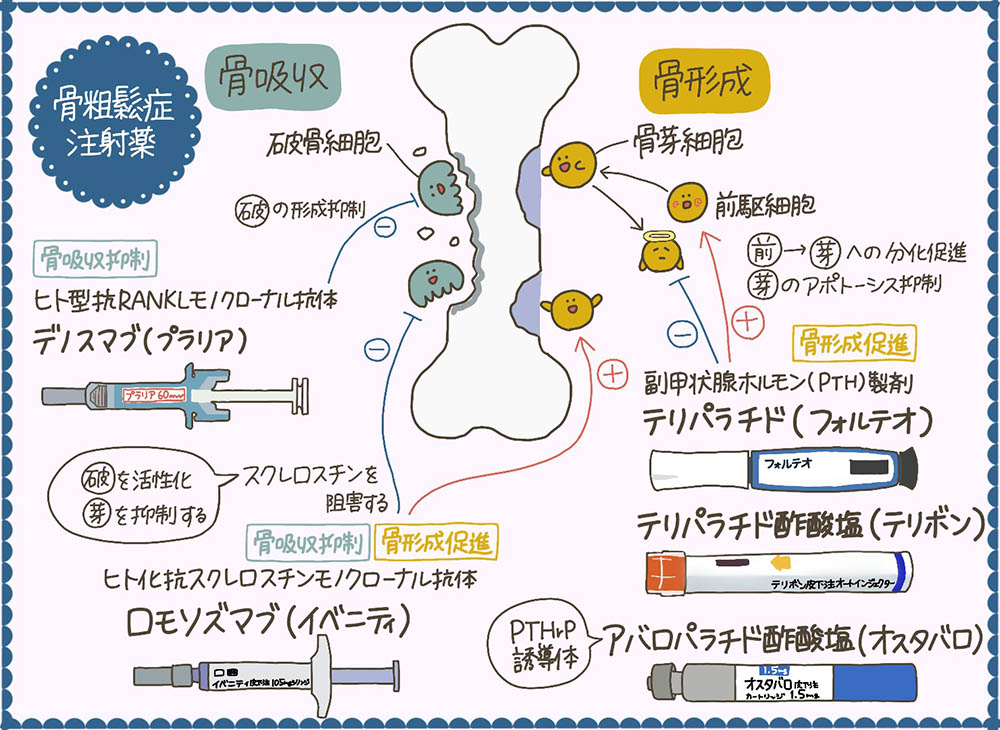 骨粗鬆症注射薬、骨吸収抑制薬と骨形成促進薬の特徴