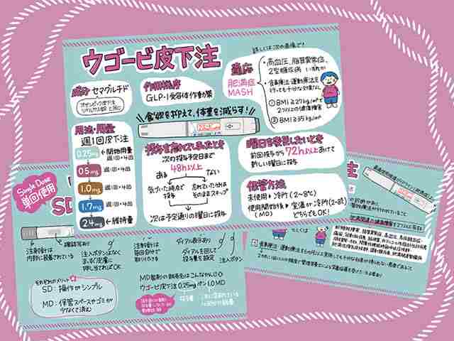 ウゴービどう使う？SD・MDの違いと服薬指導法の画像